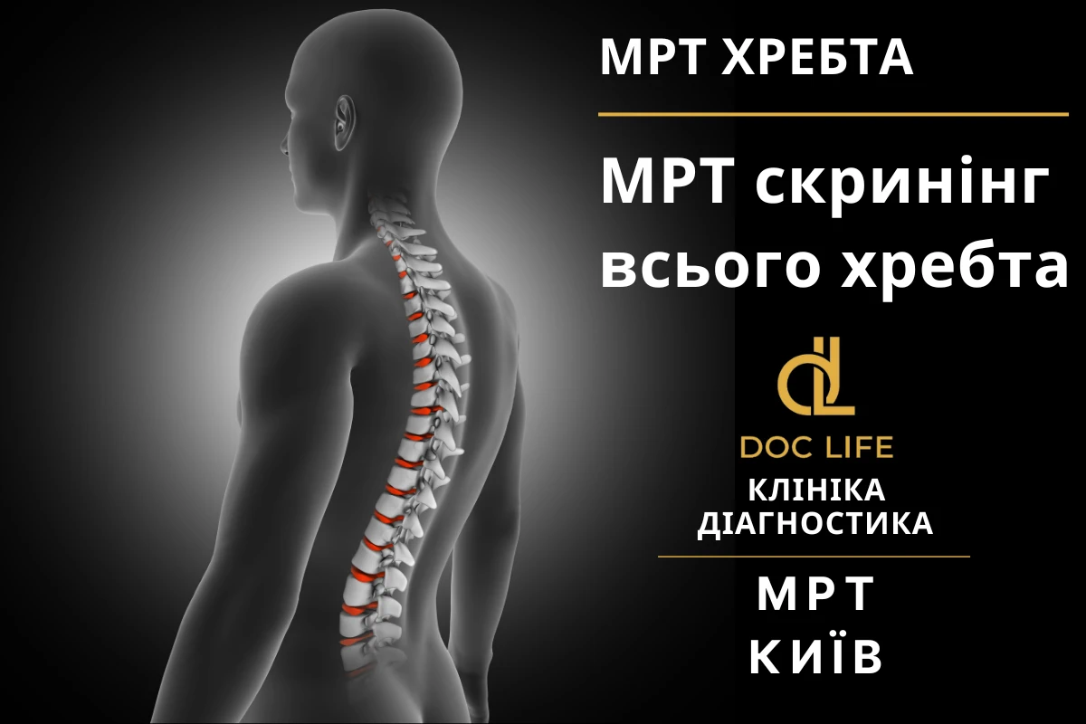 МРТ позвоночника Киев - Осокорки и Позняки клиника Doc Life