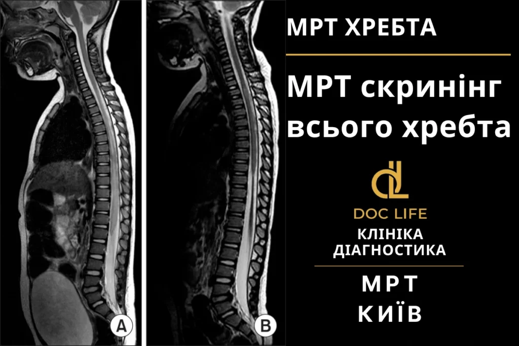 Виды МРТ отделов позвоночника в Киеве