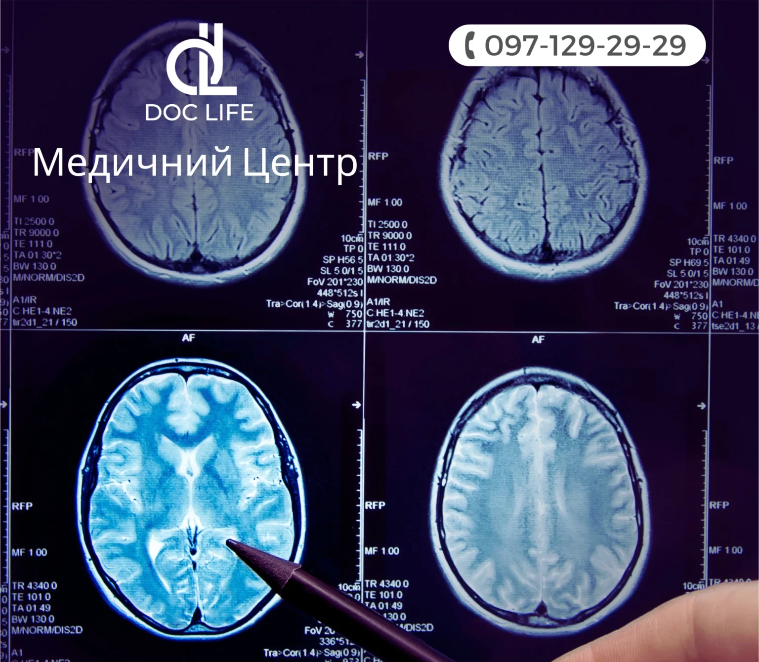 МРТ головного мозга Киев Клиника Док Лайф