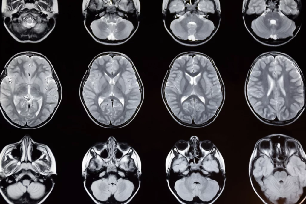 МРТ головного мозга Киев Док Лайф диагностика головы МРТ головы Осокорки1