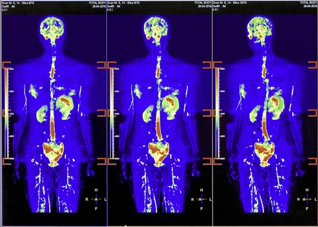 МРТ всего тела Киев осокорки Док Лайф пример сканирования скан