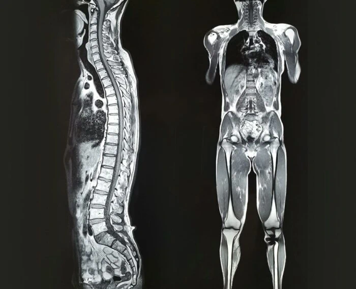 МРТ всего тела в Киеве осокорки Док Лайф пример сканирования