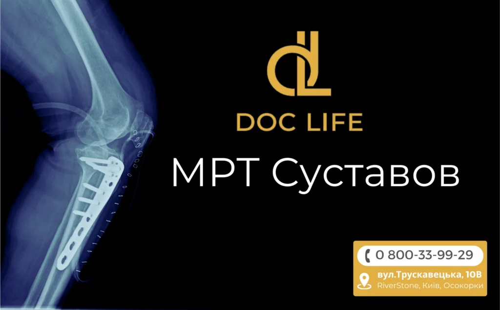 МРТ суставов Киев Осокорки 3000 грн – DocLife Клиника