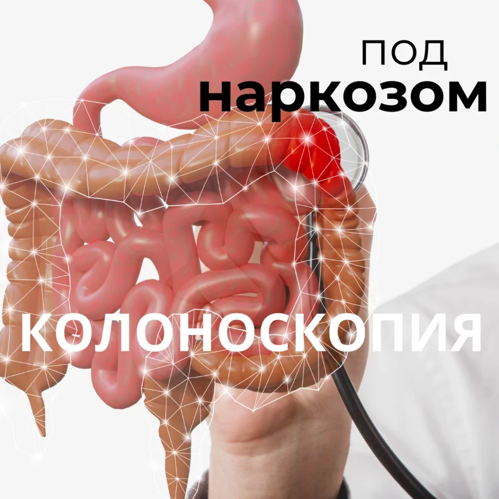 Колоноскопия под наркозом Киев Осокорки клиника Док Лайф быстрая диагностика точная диагностика