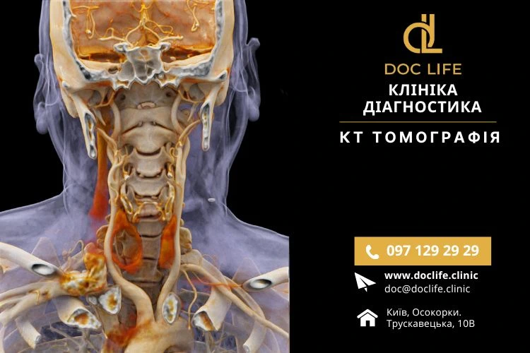 КТ гортани в Киеве — Компьютерная томография горла с контрастом Осокорки Позняки