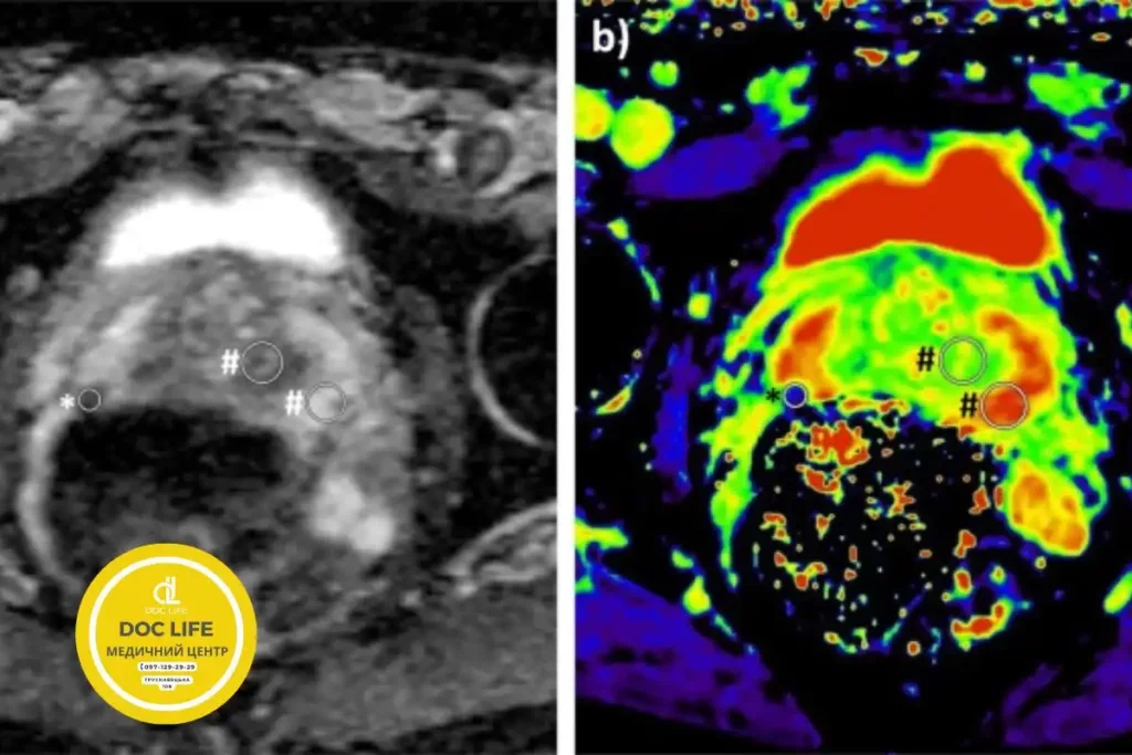 МРТ простаты МРТ предстательной железы Киев Позняки Осокорки