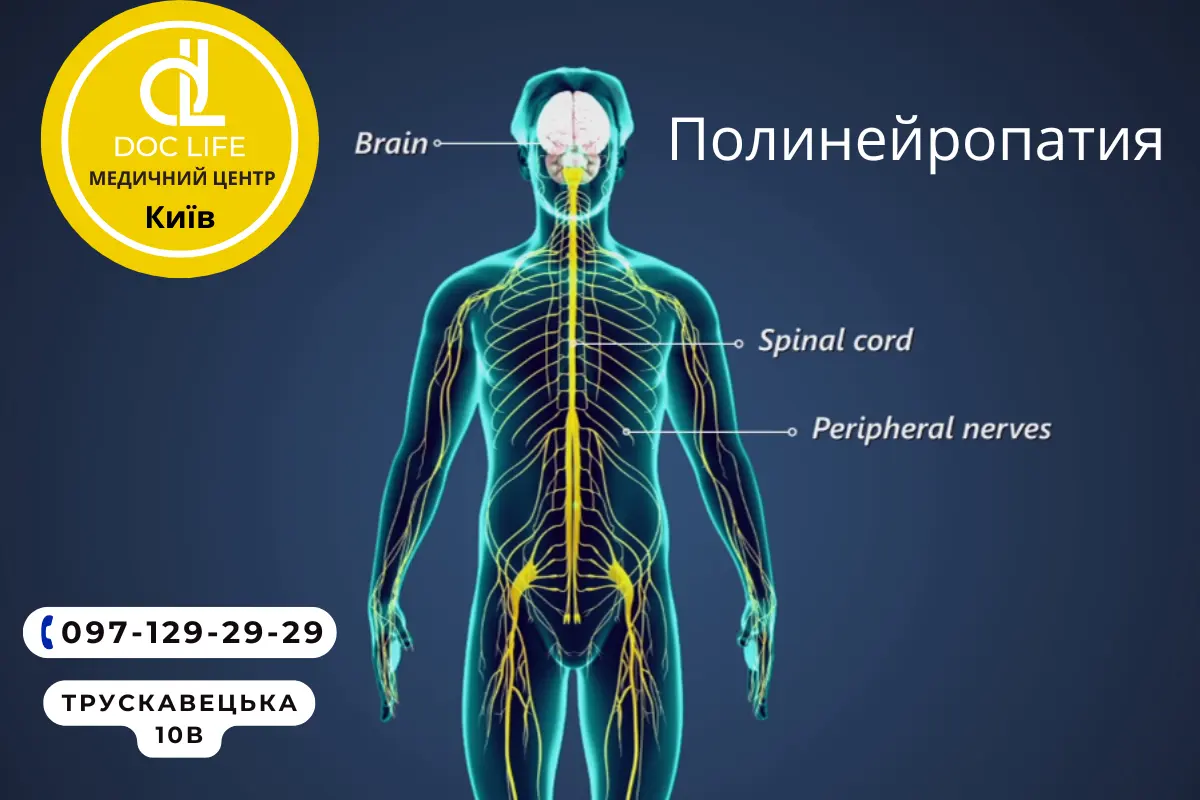 Полинейропатия консультация причины симптомы диагностика и лечение Невролог 1