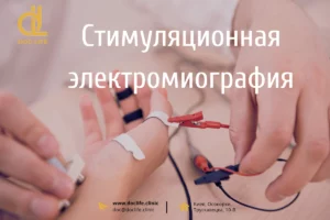 алкоголизм Стимуляционная ЭНМГ в Киеве – диагностика нервов и проводимости Стимуляционная ЭНМГ Стимуляционная электромиография в Киеве 1