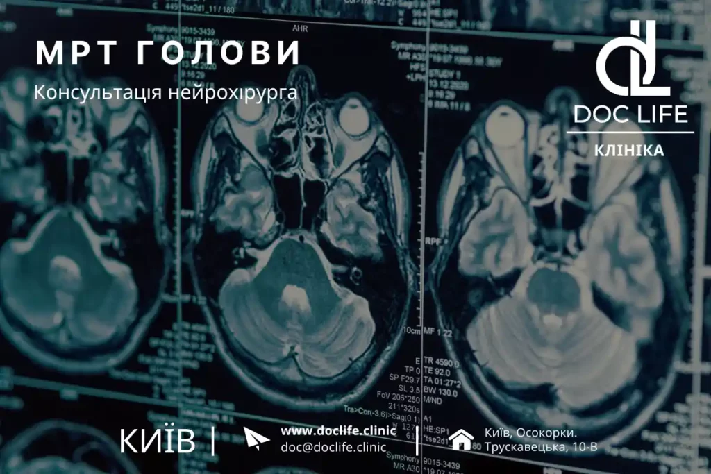МРТ головного мозку (МРТ голови) у Києві — Осокорки | від 2600 грн
