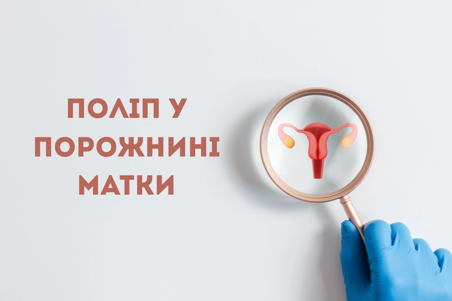 Таблиця 1. Нормальні терміни відновлення менструації після пологів Таблиця 1. Нормальні терміни відновлення менструації після пологів
