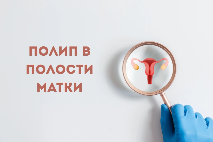 Менструальный цикл после родов может нарушаться из-за полипа в полости матки. Гинеколог Киев консультация поможет найти причину Менструальный цикл после родов может нарушаться из-за полипа в полости матки. Гинеколог Киев консультация поможет найти причину