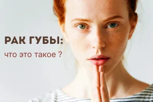 Рак губы что это такое 1
