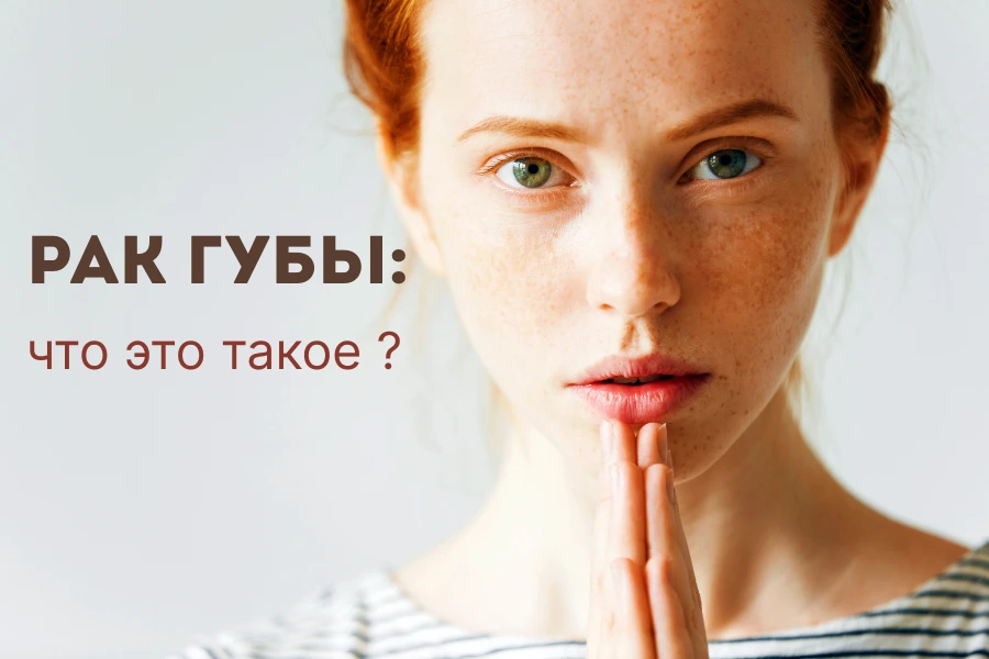 Рак губы что это такое 1