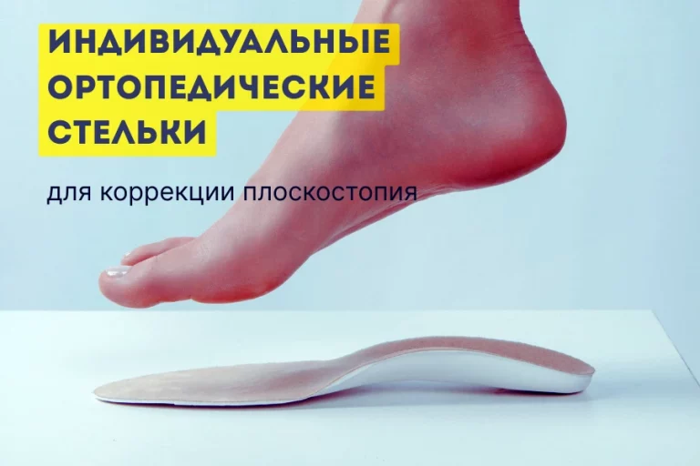 Индивидуальные ортопедические стельки 2