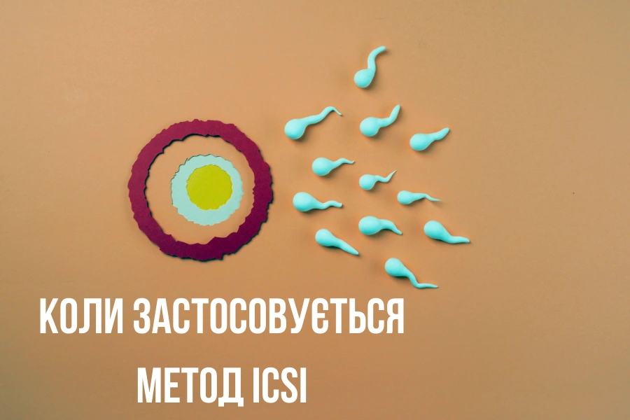 Как проходит процедура ICSI? Как проходит процедура ICSI?