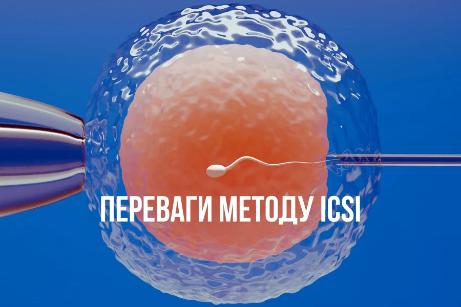 Переваги методу ICSI