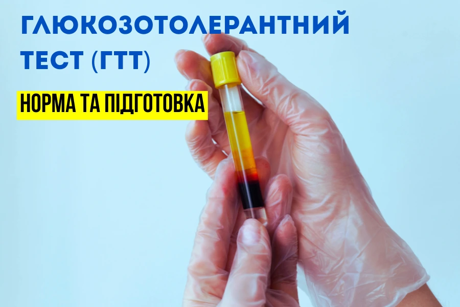 глюкозотолерантний тест (гтт) 2