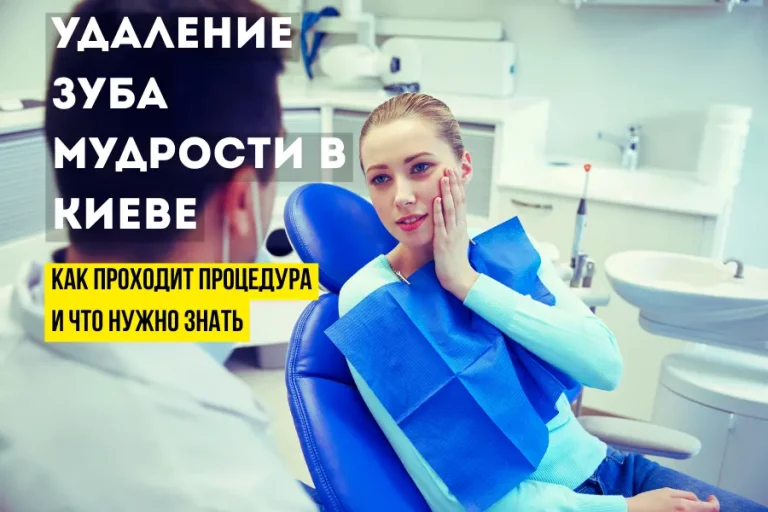 Видалення зуба мудрості у Києві: як проходить процедура та що потрібно знати