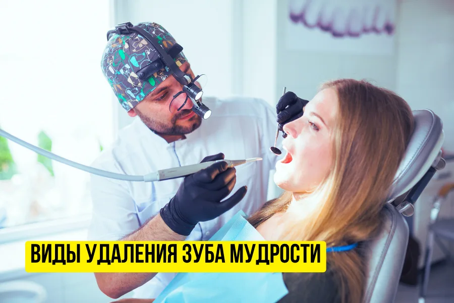 Виды удаления зуба мудрости