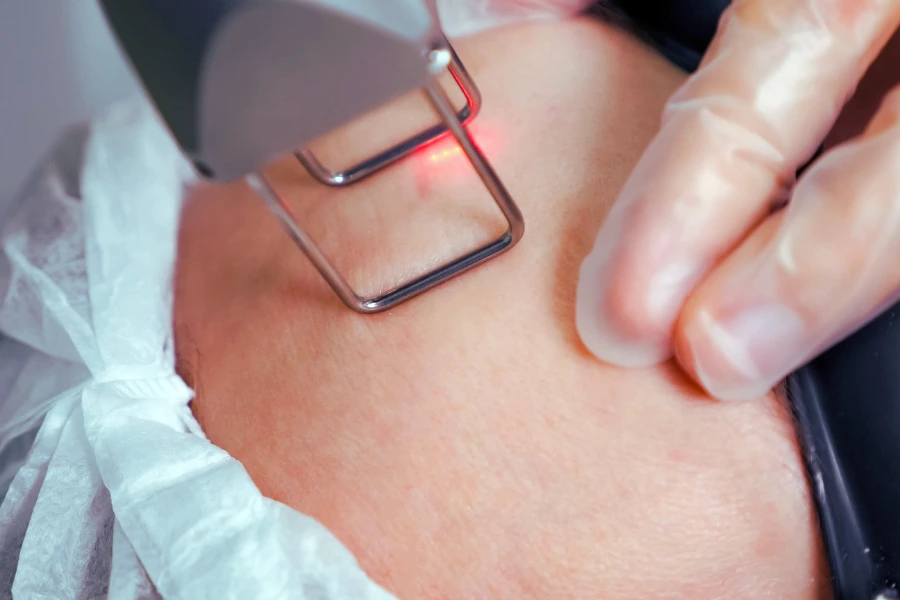 Рекомендації після шліфування