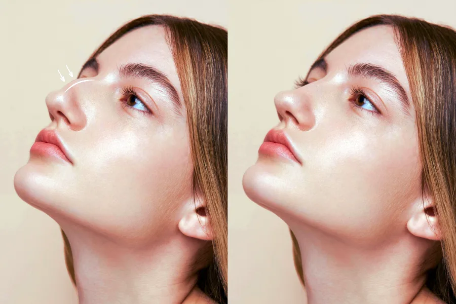 3D-моделирование: ваша виртуальная примерка нового профиля 3D-моделирование: ваша виртуальная примерка нового профиля