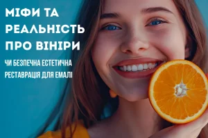 зубов мудрости Мифы и реальность о винирах: безопасна ли эстетическая реставрация для эмали
